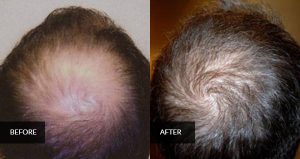 hair before and after 3