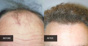 hair before and after 2