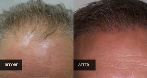 hair before and after