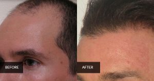 hair before and after 4