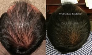 Before and after